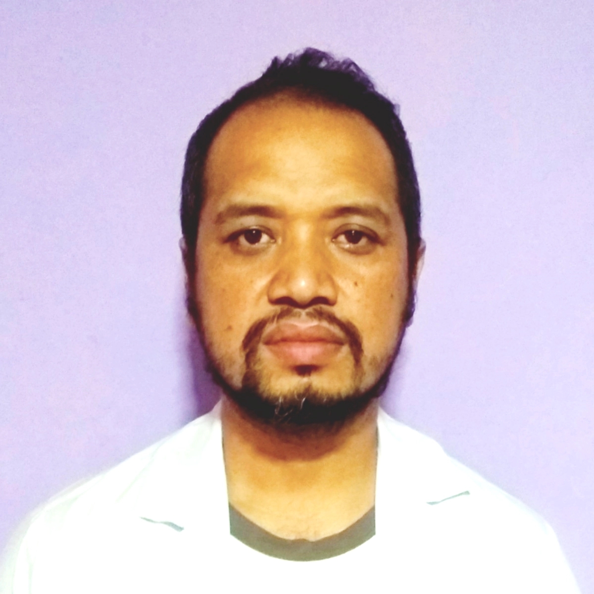 dr-achyuth-bhandari